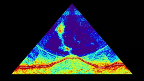 What Is That Humming Sound? thumbnail